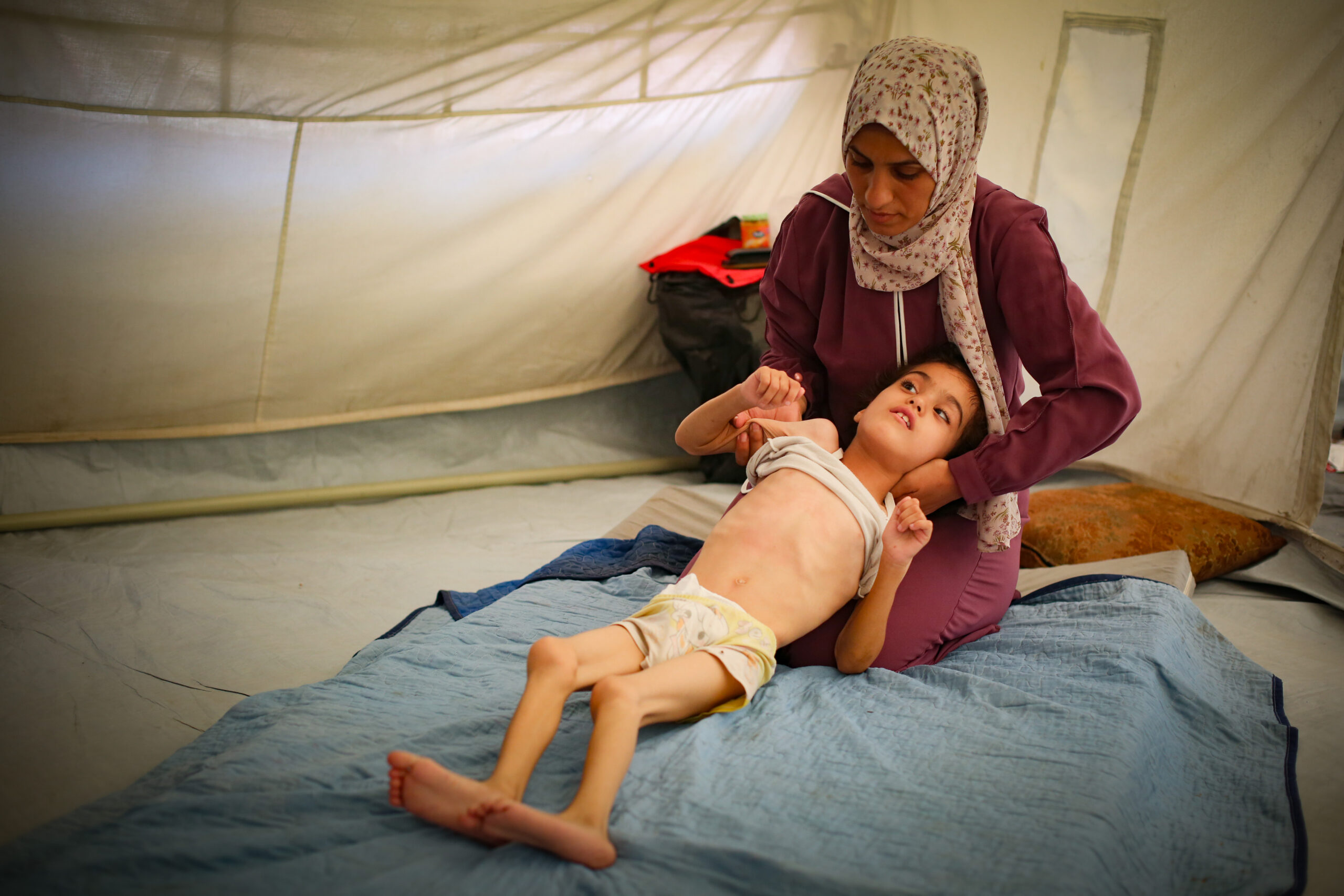 A mother tends to her malnourished child in an aid tent